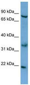 ATP Binding Cassette Subfamily D Member 2 antibody, TA332069, Origene, Western Blot image 