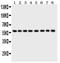 Purinergic Receptor P2X 2 antibody, LS-C357494, Lifespan Biosciences, Western Blot image 