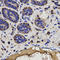 Fragile Histidine Triad Diadenosine Triphosphatase antibody, A01200-2, Boster Biological Technology, Immunohistochemistry frozen image 
