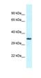 Fibronectin Type III And SPRY Domain Containing 1 Like antibody, orb326352, Biorbyt, Western Blot image 