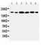 Laminin Subunit Gamma 1 antibody, PA5-79577, Invitrogen Antibodies, Western Blot image 