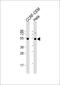 Tubulin Beta 1 Class VI antibody, 63-746, ProSci, Western Blot image 