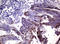 HIF-2-alpha antibody, LS-C793835, Lifespan Biosciences, Immunohistochemistry paraffin image 