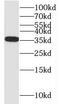 Nitrilase homolog 1 antibody, FNab05741, FineTest, Western Blot image 