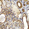 NME/NM23 Nucleoside Diphosphate Kinase 2 antibody, LS-C349144, Lifespan Biosciences, Immunohistochemistry paraffin image 