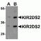 Killer Cell Immunoglobulin Like Receptor, Two Ig Domains And Short Cytoplasmic Tail 2 antibody, TA349181, Origene, Western Blot image 