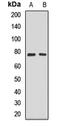 Septin 9 antibody, LS-C668614, Lifespan Biosciences, Western Blot image 