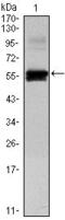 Paired Box 6 antibody, GTX82816, GeneTex, Western Blot image 