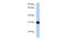 RNA Binding Protein, MRNA Processing Factor antibody, A07130, Boster Biological Technology, Western Blot image 