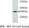 Noggin antibody, MBS355051, MyBioSource, Western Blot image 