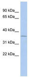Uridine Phosphorylase 1 antibody, TA346356, Origene, Western Blot image 