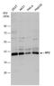 XRP2 antibody, GTX130862, GeneTex, Western Blot image 