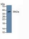 Mitogen-Activated Protein Kinase Kinase 3 antibody, MBS2001611, MyBioSource, Western Blot image 