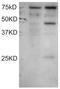 Integrin Subunit Beta 5 antibody, orb19000, Biorbyt, Western Blot image 