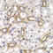 CD38 Molecule antibody, STJ22994, St John