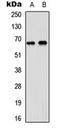 Solute Carrier Family 34 Member 2 antibody, orb253381, Biorbyt, Western Blot image 
