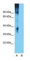 PPARG Coactivator 1 Alpha antibody, orb330094, Biorbyt, Western Blot image 