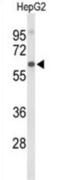Afamin antibody, abx034375, Abbexa, Western Blot image 