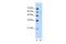 Iroquois Homeobox 4 antibody, A10295, Boster Biological Technology, Western Blot image 