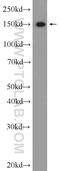 THO Complex 2 antibody, 55178-1-AP, Proteintech Group, Western Blot image 