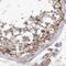 Protein Disulfide Isomerase Family A Member 5 antibody, NBP1-92250, Novus Biologicals, Immunohistochemistry paraffin image 