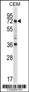 TOR antibody, 57-272, ProSci, Western Blot image 