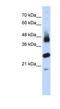 F-Box And Leucine Rich Repeat Protein 2 antibody, NBP1-55279, Novus Biologicals, Western Blot image 