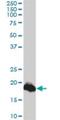 Claudin 1 antibody, H00009076-M01, Novus Biologicals, Western Blot image 