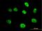 Minichromosome Maintenance Complex Component 4 antibody, H00004173-B01P, Novus Biologicals, Immunofluorescence image 