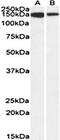 MCF.2 Cell Line Derived Transforming Sequence Like antibody, orb107644, Biorbyt, Western Blot image 