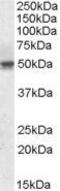 Septin 6 antibody, GTX88399, GeneTex, Western Blot image 