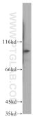 Kinesin Family Member 18A antibody, 19245-1-AP, Proteintech Group, Western Blot image 