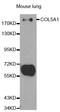 Collagen Type V Alpha 1 Chain antibody, MBS127486, MyBioSource, Western Blot image 