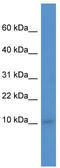 Immediate Early Response 3 Interacting Protein 1 antibody, TA341996, Origene, Western Blot image 