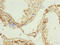 Meiotic recombination protein REC8 homolog antibody, LS-C676382, Lifespan Biosciences, Immunohistochemistry paraffin image 