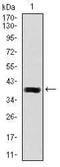 Delta Like Canonical Notch Ligand 4 antibody, MA5-17069, Invitrogen Antibodies, Western Blot image 