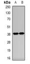 Casein Kinase 1 Alpha 1 antibody, orb382647, Biorbyt, Western Blot image 