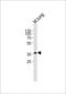 Aryl Hydrocarbon Receptor antibody, orb224164, Biorbyt, Western Blot image 