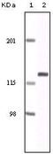 EPH Receptor A2 antibody, MA5-15284, Invitrogen Antibodies, Western Blot image 