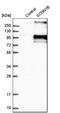 Sodium Channel Epithelial 1 Beta Subunit antibody, NBP1-84844, Novus Biologicals, Western Blot image 