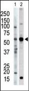 Protein Kinase C And Casein Kinase Substrate In Neurons 2 antibody, PA5-15354, Invitrogen Antibodies, Western Blot image 