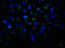 Rho Associated Coiled-Coil Containing Protein Kinase 2 antibody, CSB-RA152329A0HU, Cusabio, Immunofluorescence image 