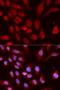 Ubiquitin Like With PHD And Ring Finger Domains 1 antibody, LS-C332075, Lifespan Biosciences, Immunofluorescence image 