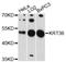 Keratin 36 antibody, LS-C748786, Lifespan Biosciences, Western Blot image 