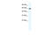 DEAD-Box Helicase 5 antibody, 28-483, ProSci, Western Blot image 