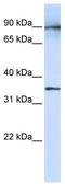 Leucine Rich Repeat Containing 59 antibody, TA331047, Origene, Western Blot image 
