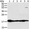 Mitochondrial Fission Process 1 antibody, PA5-50457, Invitrogen Antibodies, Western Blot image 