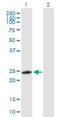 RING finger protein 114 antibody, H00055905-B01P, Novus Biologicals, Western Blot image 