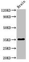 Meteorin Like, Glial Cell Differentiation Regulator antibody, LS-C681830, Lifespan Biosciences, Western Blot image 