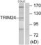 Tripartite Motif Containing 24 antibody, abx013284, Abbexa, Western Blot image 